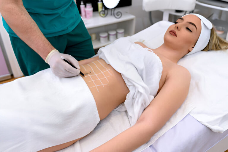Liposuction Recovery